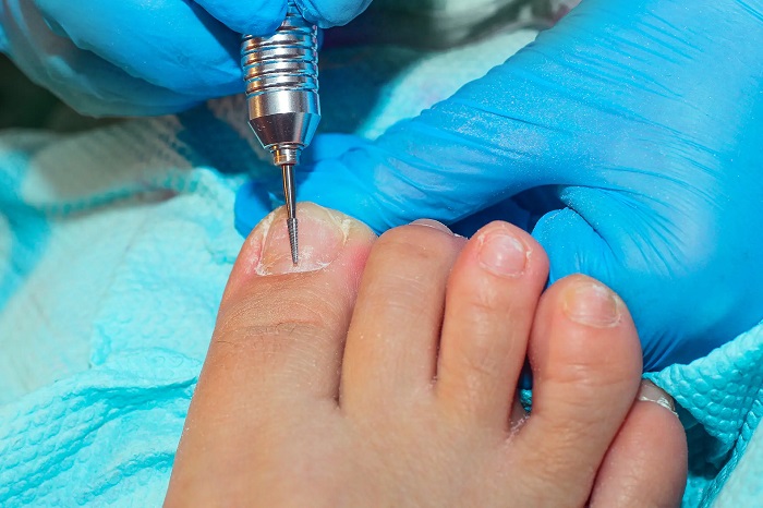 AVS PLASTIC SURGERY AND SKIN CLINIC Pudukkottai